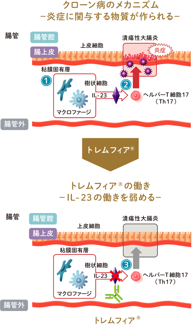 クローン病患者さんのメカニズム（炎症に関与する物質が作られる）と、トレムフィア®の働き（L-23の働きを弱める）