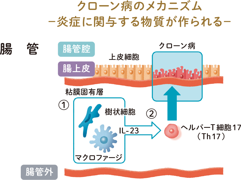 クローン病のメカニズム 一炎症に関与する物質が作られるー