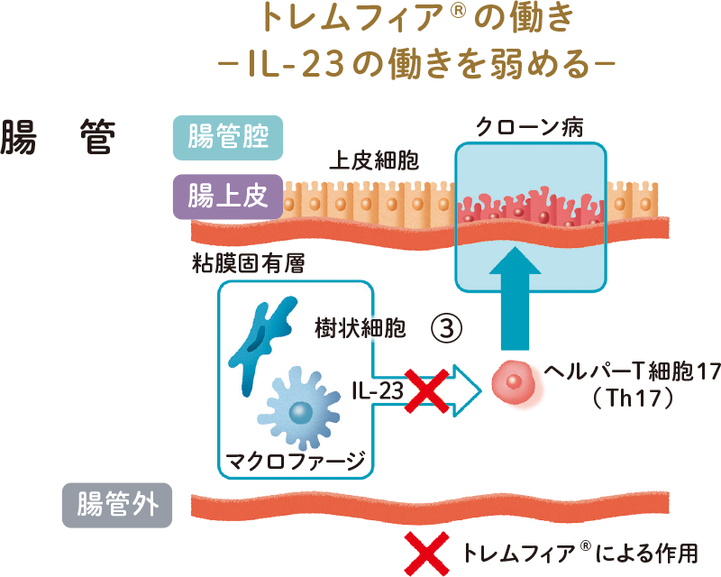 トレムフィア®の働き ーIL-23の働きを弱めるー